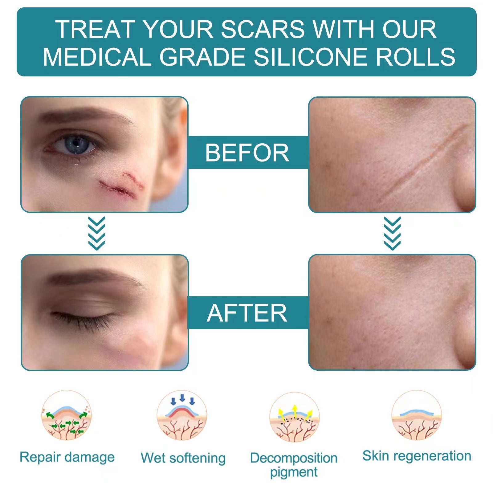 Silicone Anti-Scar Sheets for Healing - LessBarriers