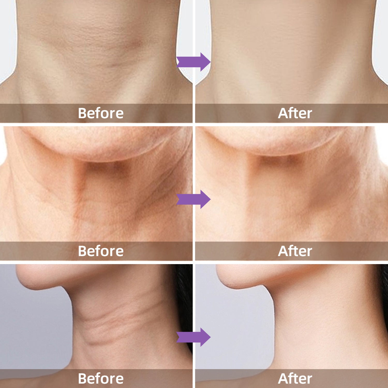 Anti-Aging Neck Cream for Firmness - LessBarriers